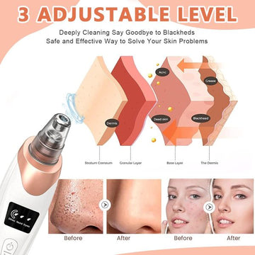 Face Vacuum Blackhead Remover Pore Cleaner | Electric Deep Cleansing Tool For Nose & Face